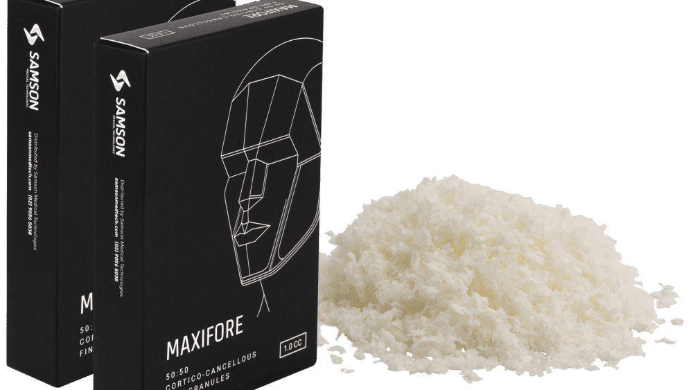 Maxifore bone grafting products